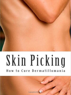 cover image of Skin Picking